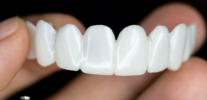 Affordable Artificial Tooth Replacement