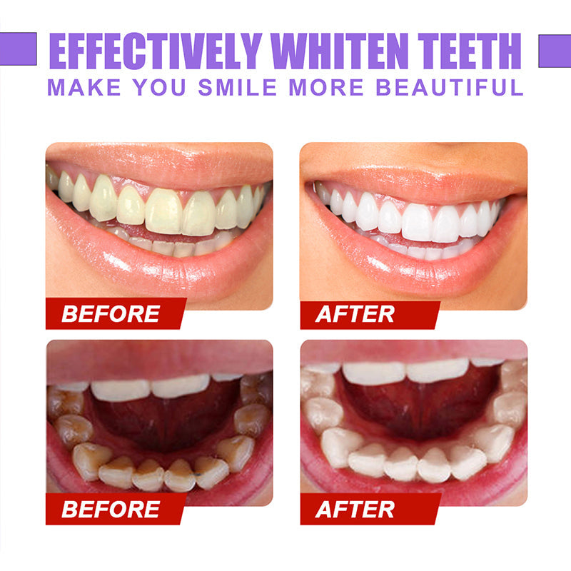 Teeth Whitening Color Fix Pen