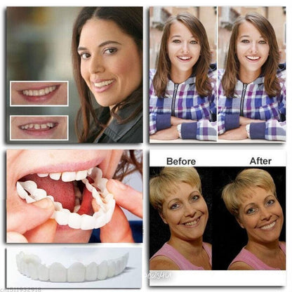 Easy Fit Snap-In Dentures