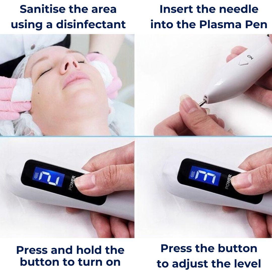 Portable Skin Tag Remover Pen - Easy At Home Use