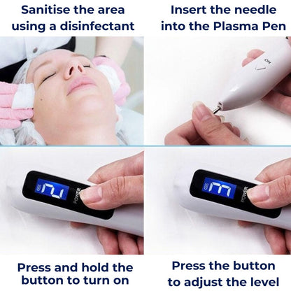 Portable Skin Tag Remover Pen - Easy At Home Use