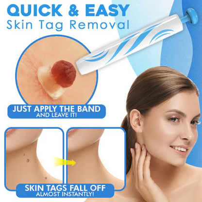 Easy Skin Tag Remover for Men and Women