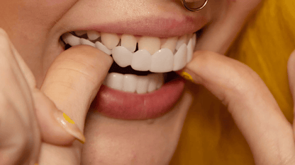 Easy Snap On Smile Dental Veneers