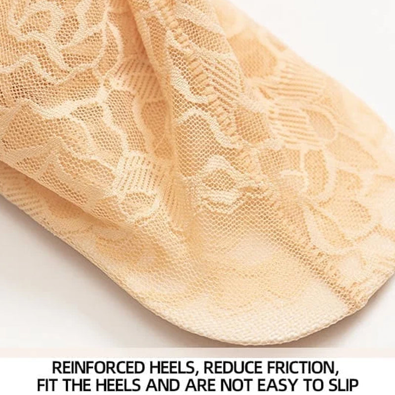 Trendy Women's Lace Ankle Socks