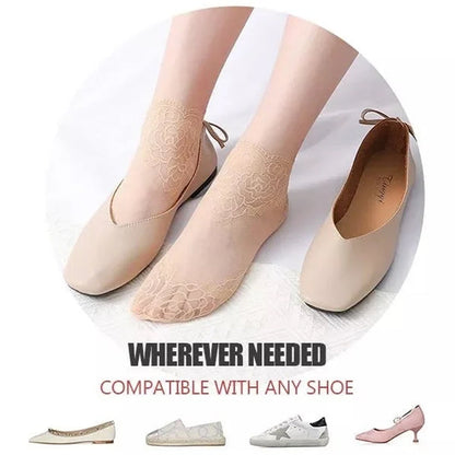 Trendy Women's Lace Ankle Socks