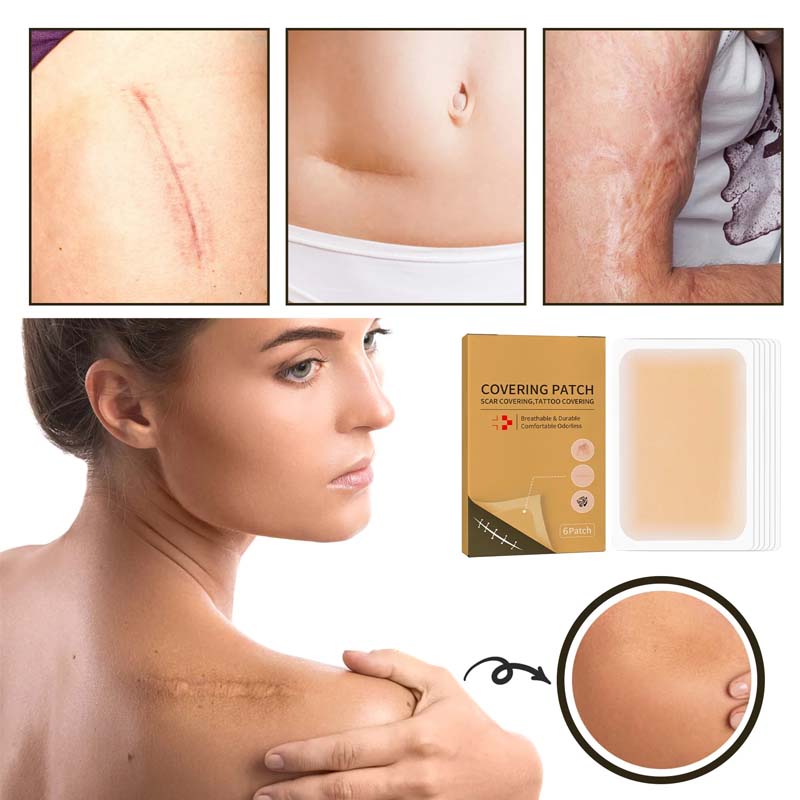 Clear Skin Concealing Beauty Patches