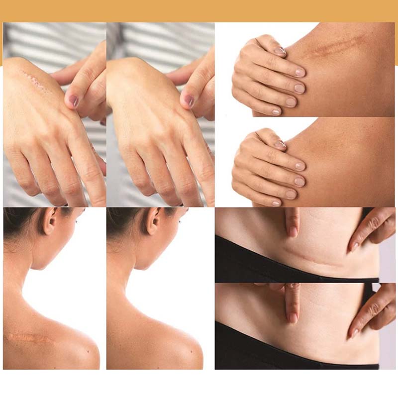 Clear Skin Concealing Beauty Patches