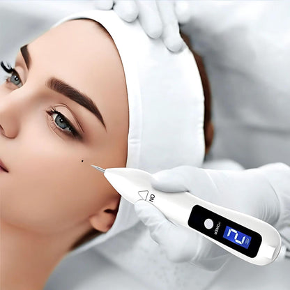 Portable Skin Tag Remover Pen - Easy At Home Use