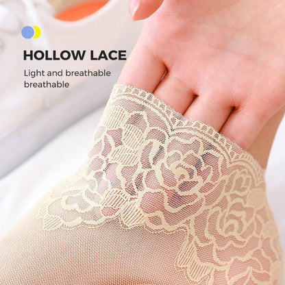 Trendy Women's Lace Ankle Socks