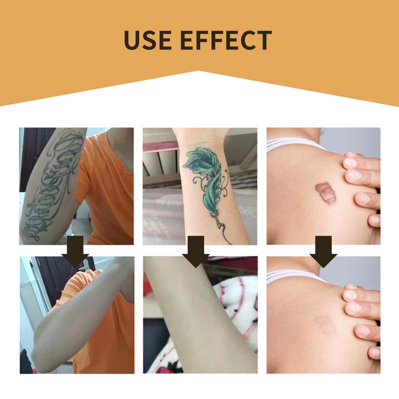 Clear Skin Concealing Beauty Patches
