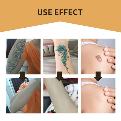 Clear Skin Concealing Beauty Patches