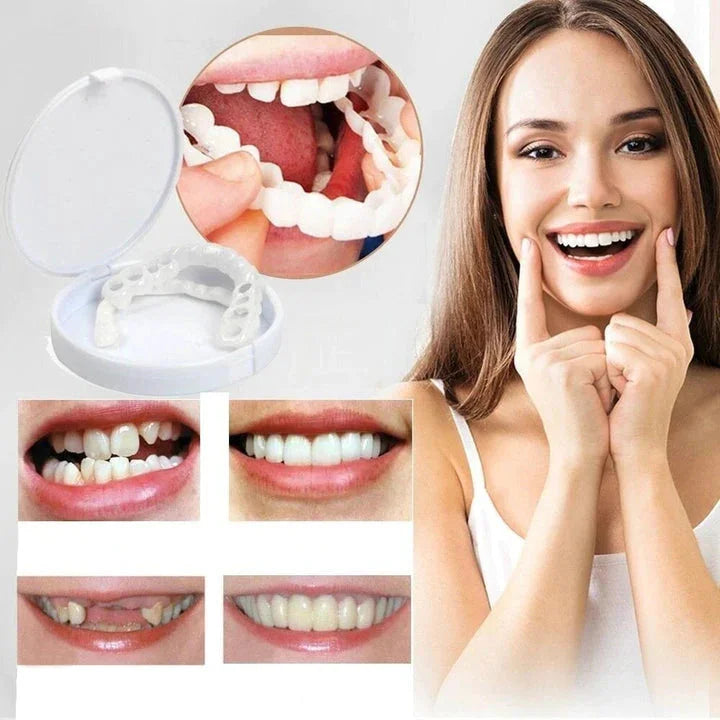 Easy Snap On Smile Dental Veneers