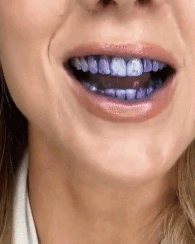 Teeth Whitening Color Fix Pen