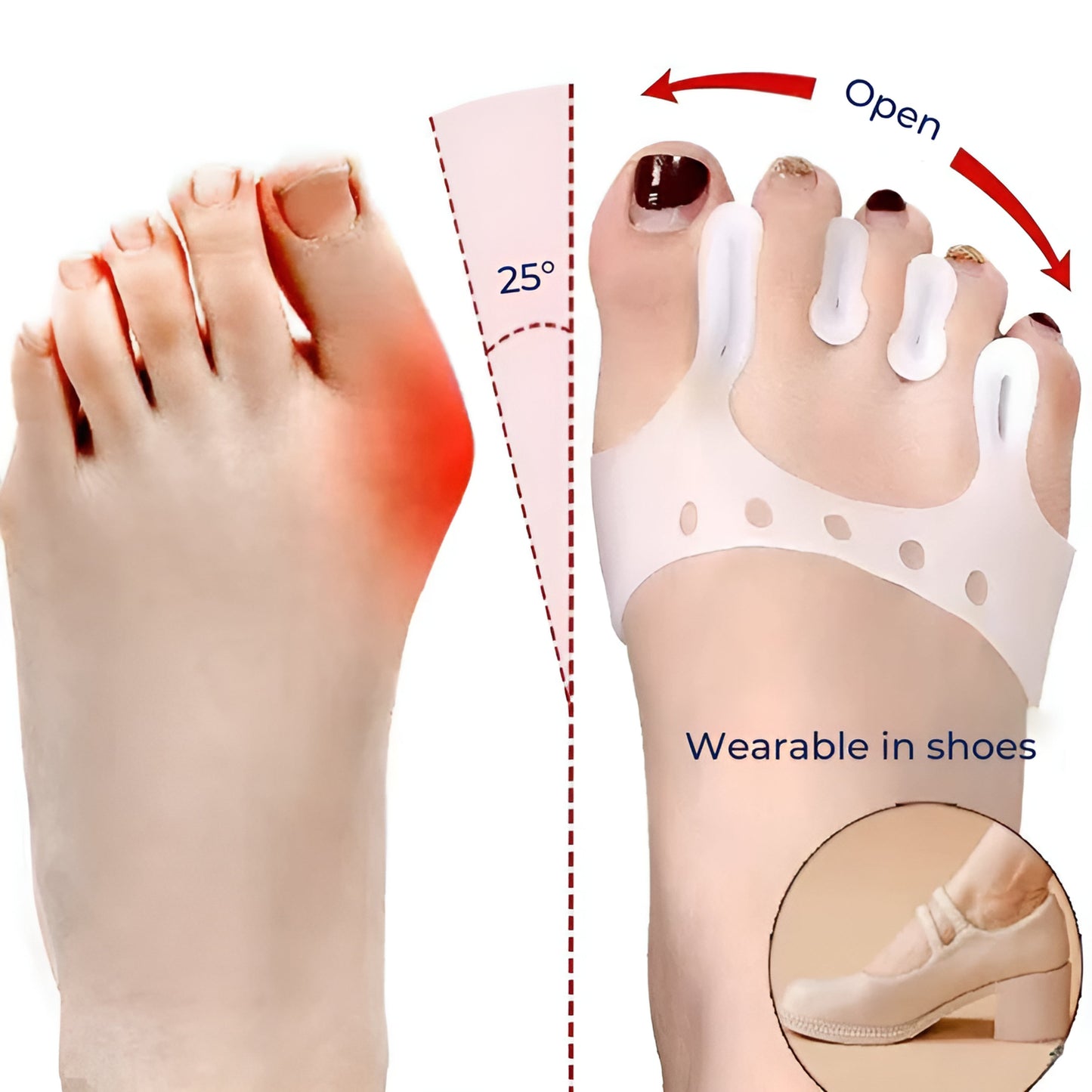 Orthotic Support Arch Insoles for All Day Pain Relief