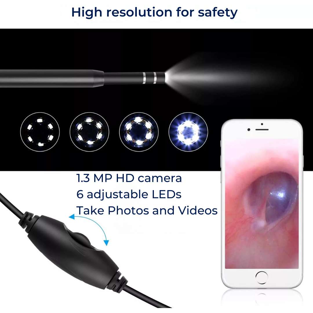 Advanced Ear Camera with HD Video and Wax Removal