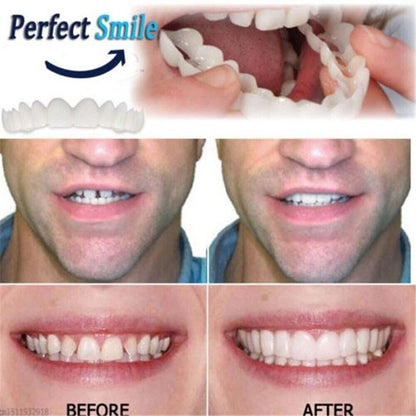 Easy Fit Snap-In Dentures