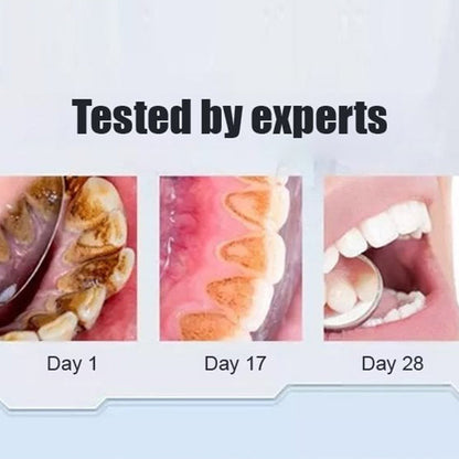 Natural Probiotic Toothpaste with 6 Strains
