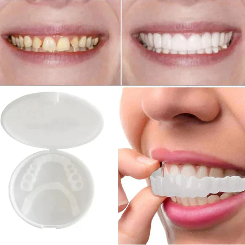 EasyFit Dental Restoration for Perfect Smile