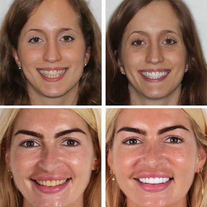 Natural Probiotic Toothpaste with 6 Strains