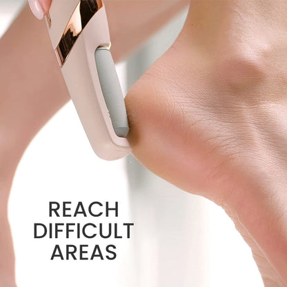 Portable Electric Foot Callus Remover