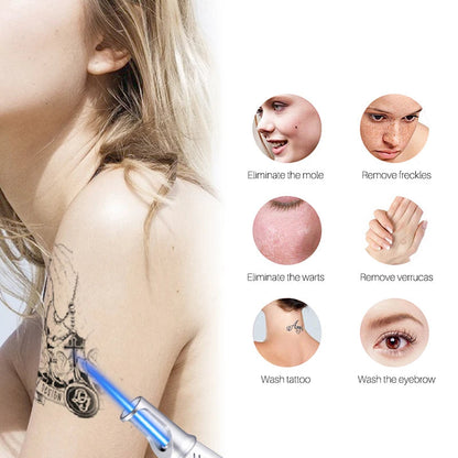 Professional Skin Laser Remover Pen