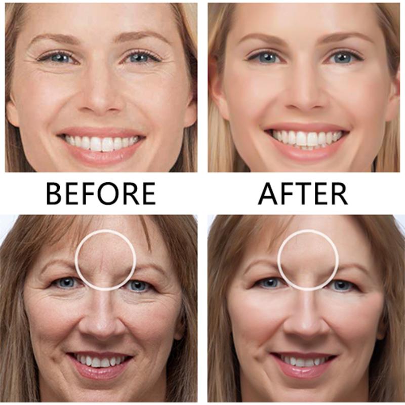 Anti Aging Face Lift Sticker Skin Care Patches