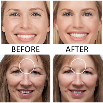 Anti Aging Face Lift Sticker Skin Care Patches