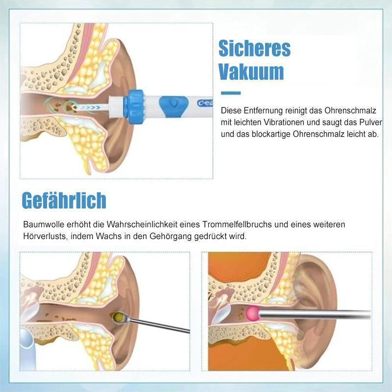Gentle Ear Cleaner Vacuum – Easy to Use