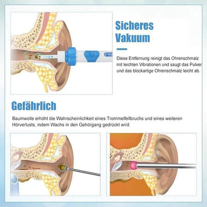 Gentle Ear Cleaner Vacuum – Easy to Use