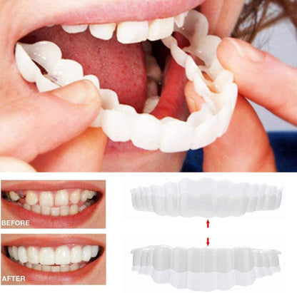 Easy Fit Dental Veneers Set
