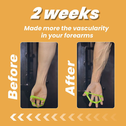 Best Grip Strengthener Set for Hand Exercise