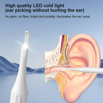 Advanced Ear Cleaner Kit with HD Camera
