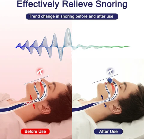 Portable Mini CPAP Sleep Apnea Device for Travel