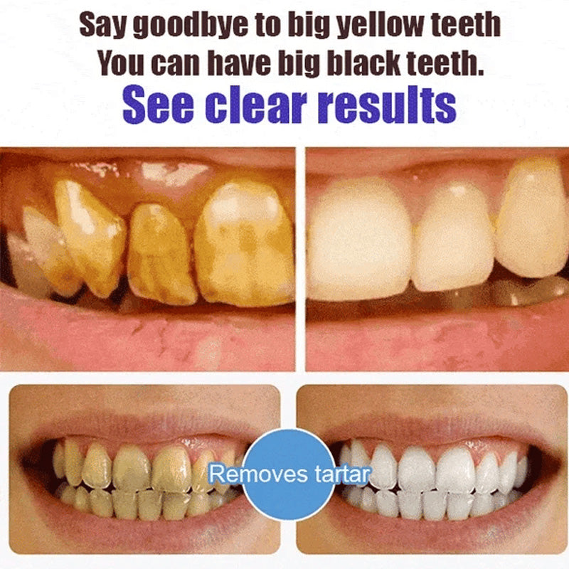 Natural Probiotic Toothpaste with 6 Strains