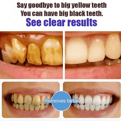 Natural Probiotic Toothpaste with 6 Strains