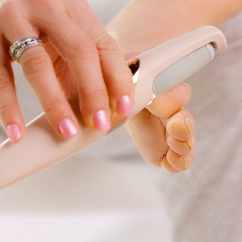 Portable Electric Foot Callus Remover