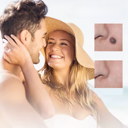 Fast Acting Wart Treatment Cream