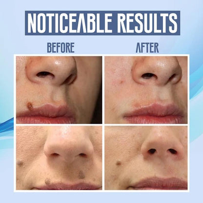 Easy Facial Hair Remover Pen