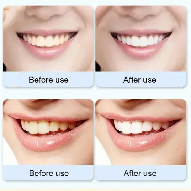 Natural Probiotic Toothpaste with 6 Strains
