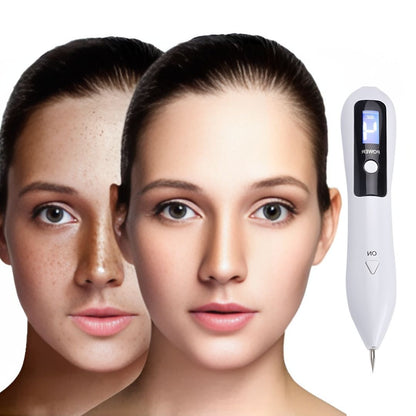 Portable Skin Tag Remover Pen - Easy At Home Use