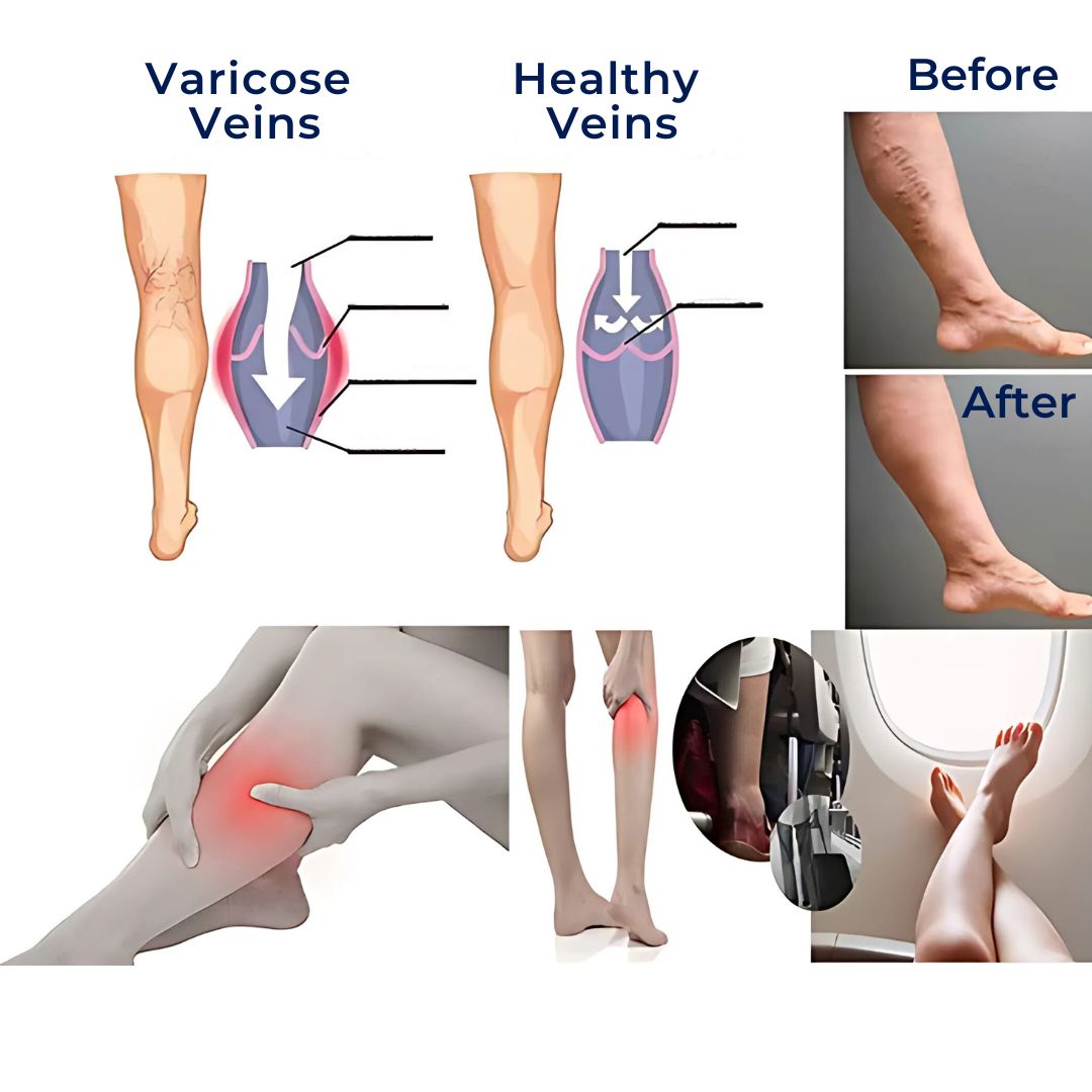 Breathable Compression Socks for Men and Women