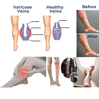 Breathable Compression Socks for Men and Women