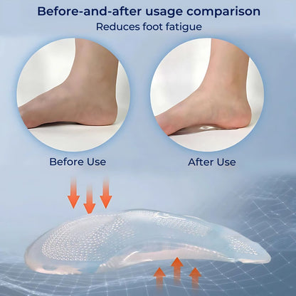Orthotic Gel Insoles for Foot Pain Relief