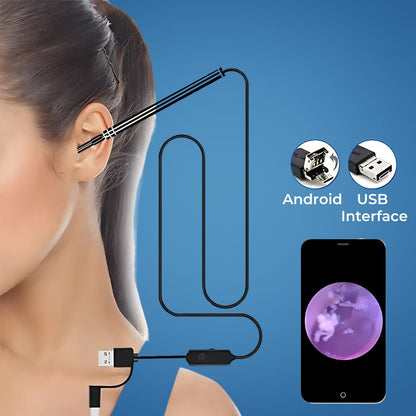Advanced Ear Camera with HD Video and Wax Removal - Cofik
