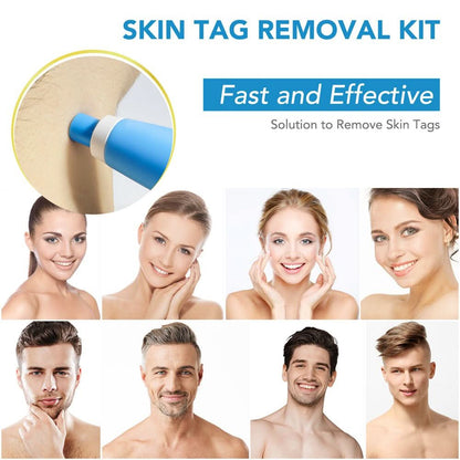Effective Wart and Mole Remover Cream
