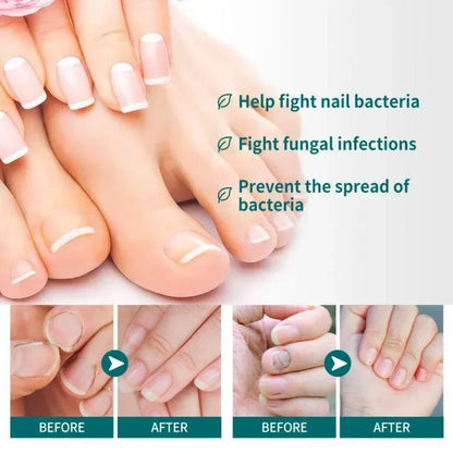 Natural Nail Fungus Treatment Serum