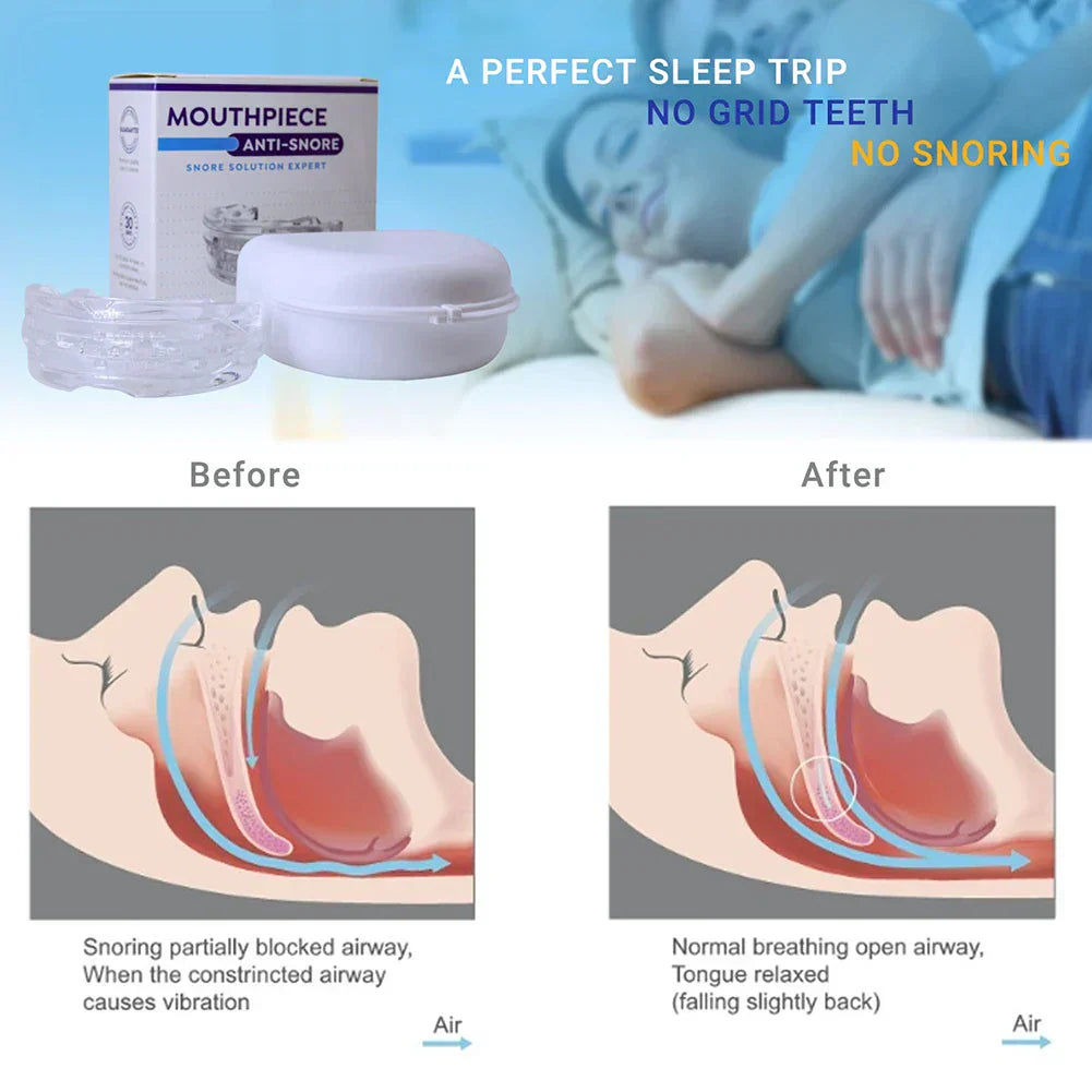 Stop Snore Sleep Aid Device