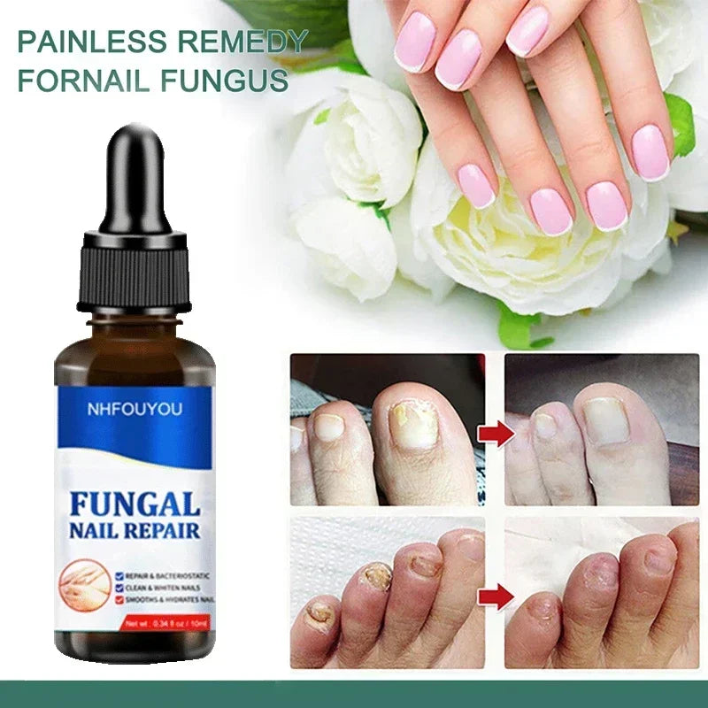 Natural Nail Fungus Treatment Serum