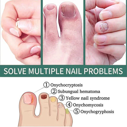 Natural Nail Fungus Treatment Serum