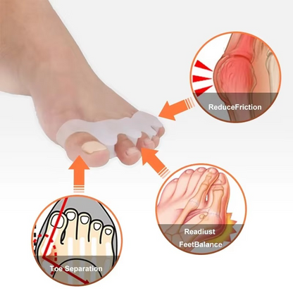 Gel Toe Spacers for Bunion Pain Relief and Comfort